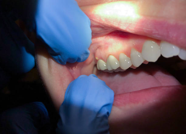 Best Emergency Dental Services for Seniors in Porterdale, GA